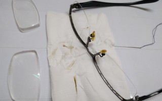 金属眼镜氧化怎么去除，金属眼镜氧化怎么去除掉