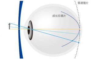 成长悦镜片什么作用，成长悦镜片适用人群