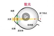 散光如何换算，散光如何换算隐形眼镜度数